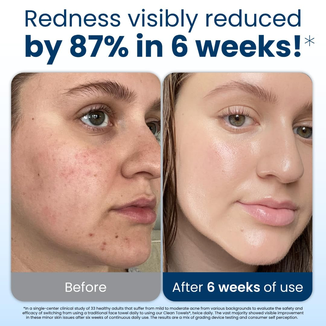 Clean Skin Club XL® Biobased Face Towels, 100% USDA Certified, Disposable Makeup Remover Wipes, Eczema Association Approved, Ultra Soft, 50 Count Pack